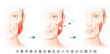 爱嚼口香糖影响脸型怎么改善?