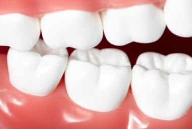 长期不镶牙会带来哪些麻烦？