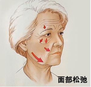 微整形,玻尿酸,BOTOX,长春好的整形医院