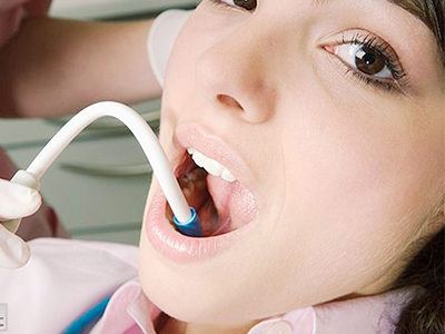 超声波洗牙可以治疗口臭吗