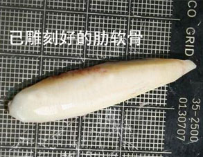 隆鼻,自体软骨,长春好的整形医院