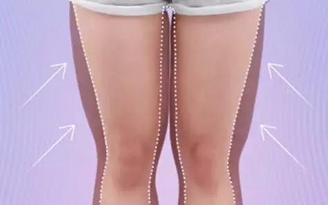 水动力吸脂,长春好的整形医院