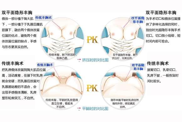 丰胸,隆胸,假体,长春好的整形医院
