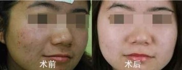 激光美容对比,铭医,激光美容,除皱,嫩肤