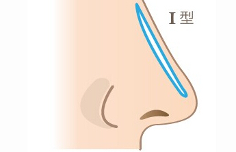 猪鼻子,隆鼻,吉林铭医 猪鼻子,隆鼻,吉林铭医