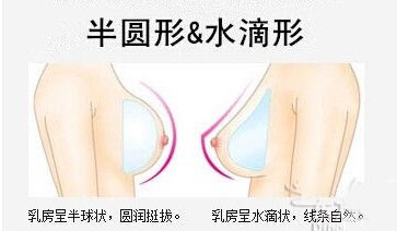 隆胸假体