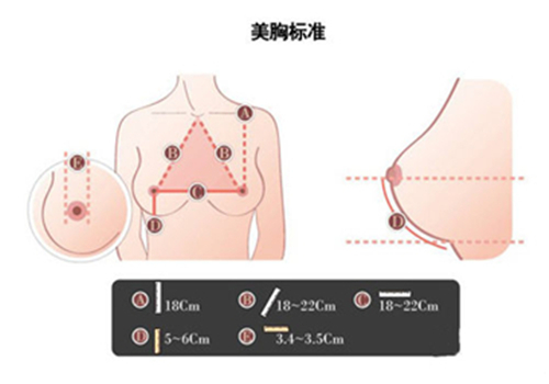 美胸,假体隆胸,吉林铭医