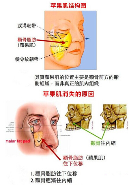 苹果肌,结构示意图,长春好的整形医院