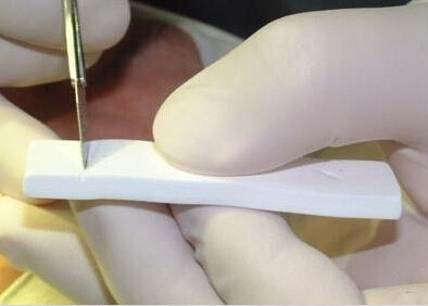 隆鼻,材料,膨体,长春好的整形医院
