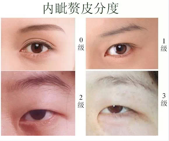 眼距,三庭五眼,标准,长春好的整形医院
