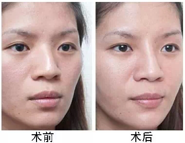 眼距,三庭五眼,标准,长春好的整形医院