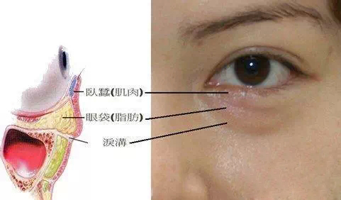 眼沟位置图片图片