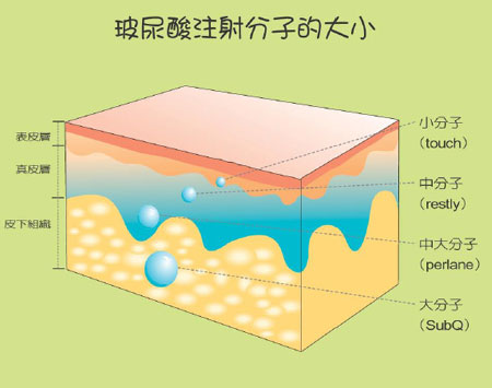 玻尿酸,大分子,小分子,长春好的整形医院