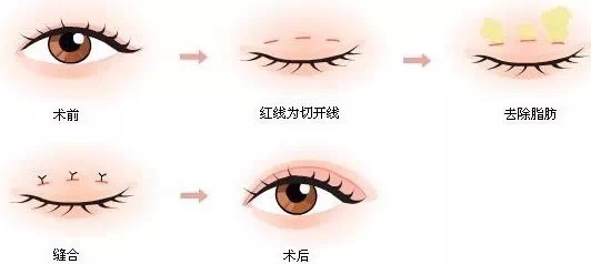 对身体没有伤害,微创,微整形,长春好的整形医院