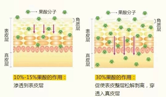 果酸换肤,原理,长春好的整形医院