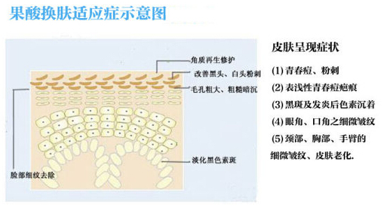 果酸换肤,原理,长春好的整形医院