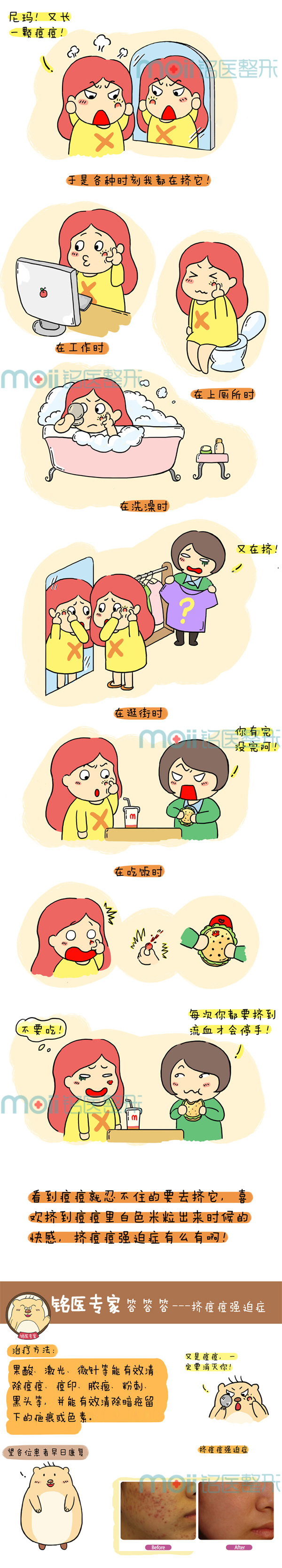 挤痘痘,强迫症,长春好的整形医院