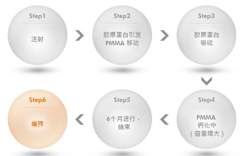 玻尿酸丰泪沟,爱贝芙丰泪沟,自体丰泪沟