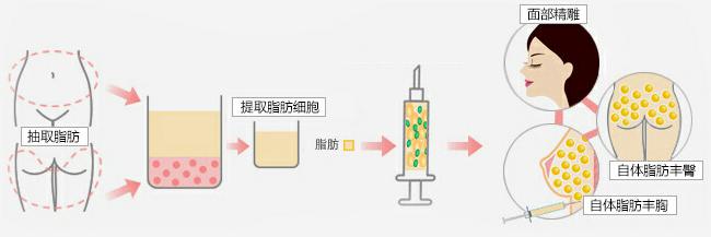 长春丰苹果肌,注射丰苹果肌,铭医丰苹果肌
