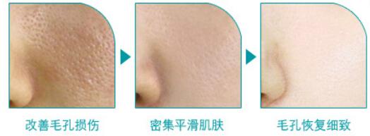 收缩毛孔对比