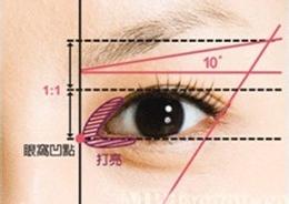 长春眼部整形