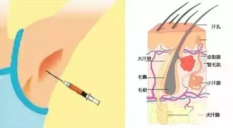 长春保妥适、保妥去腋臭