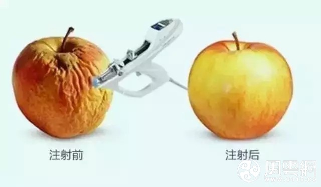 长春水光针,水光针效果