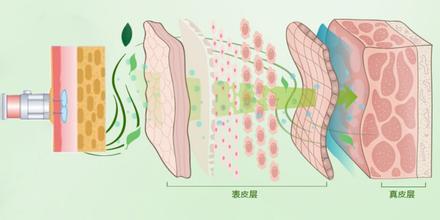 长春水光针,水光针效果