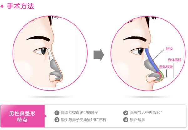 长春男士整形,长春减肥