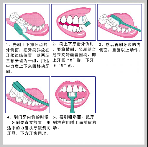 正确的刷牙方式