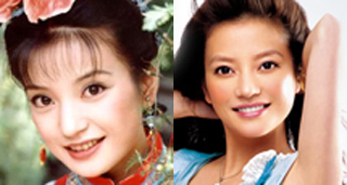 尺寸美容冠，尺寸美白牙